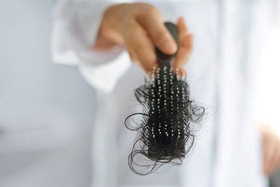 Vì sao tóc rụng nhiều?