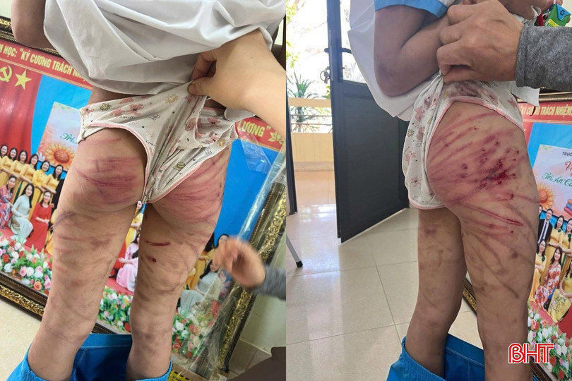 Hà Tĩnh: Cô hiệu trưởng thông tin về bé gái lớp 5 nghi bị bố dượng bạo hành dã man