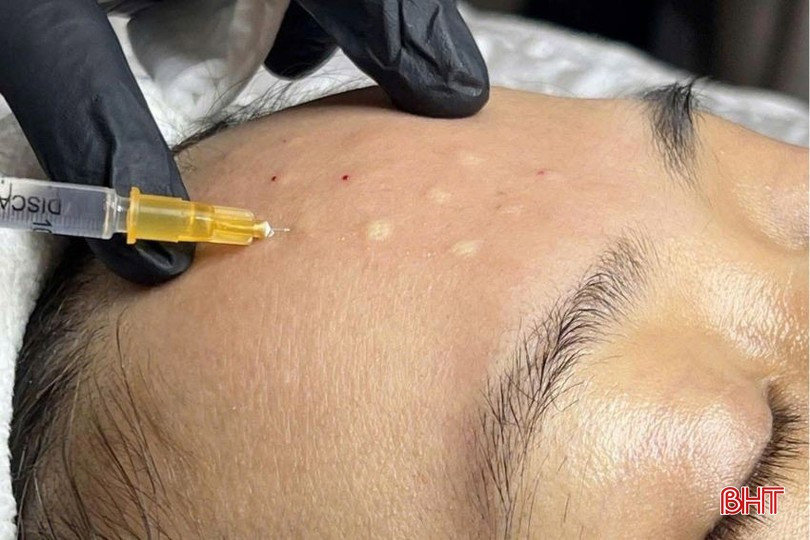 Hoạt động thẩm mỹ có xâm lấn trái phép vẫn tiếp tục diễn ra ở Hà Tĩnh