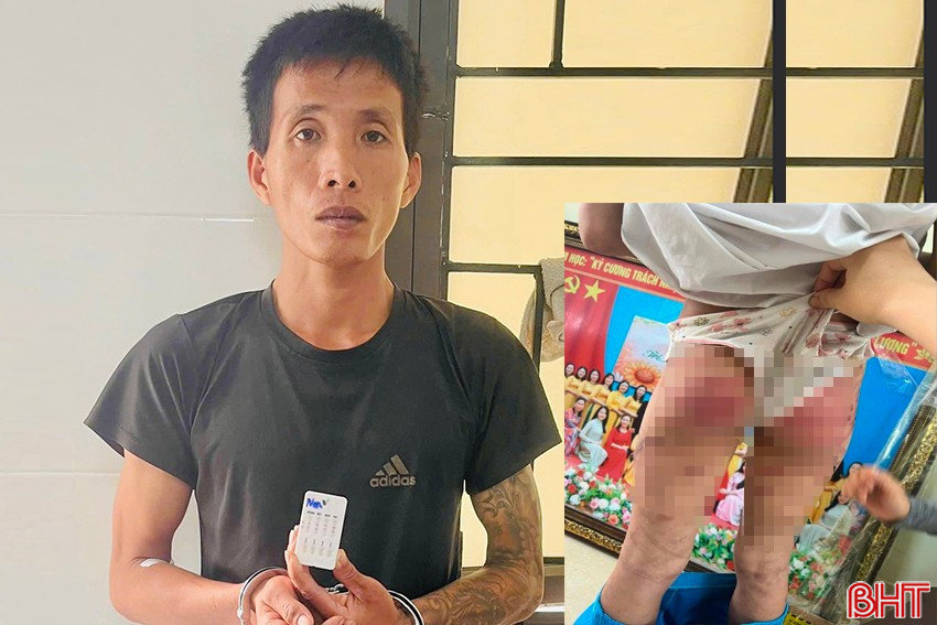 Khởi tố, tạm giam cha dượng bạo hành bé gái lớp 5 ở Hà Tĩnh