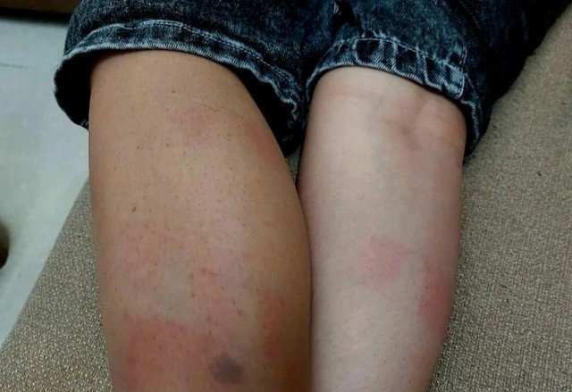 Đắk Lắk: Buộc thôi việc thầy giáo đánh học sinh vì không chịu ngủ trưa