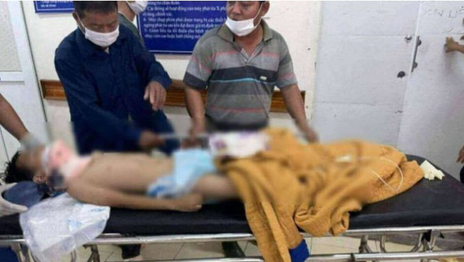 Một học sinh lớp 3 (Ích hậu, Lộc Hà) ngã từ tầng hai xuống đất, nguy kịch