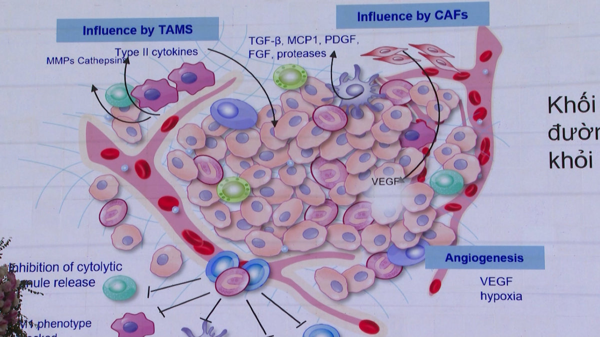 Hơn 300.000 người Việt đang sống chung với ung thư