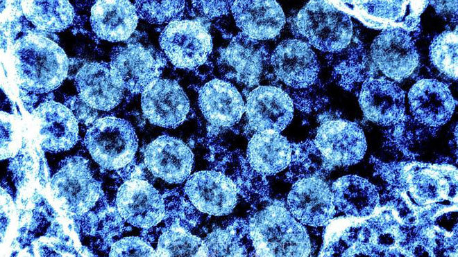 Người nhiễm biến thể Delta có thể lây lan virus 2 ngày trước khi có triệu chứng
